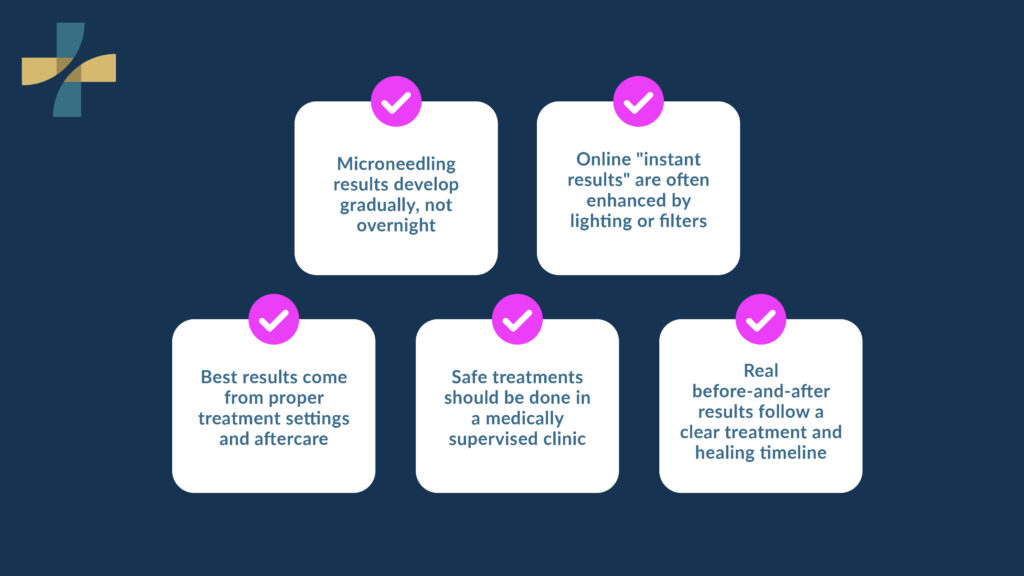 Before and after micro needling results develop gradually