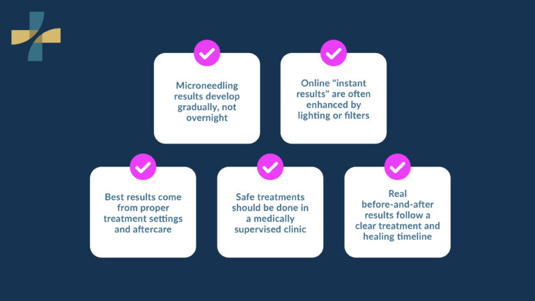 Before and after micro needling results develop gradually