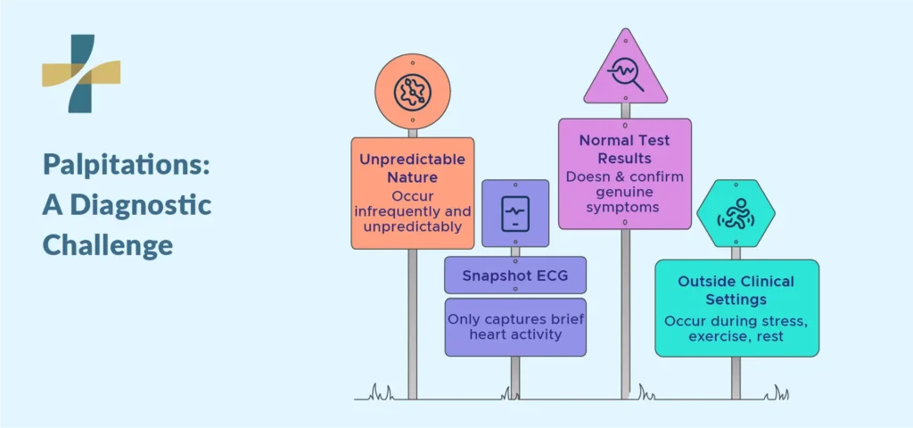palpitations, a diagnostic challenge