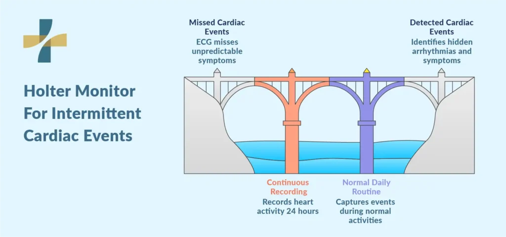 Holter monitor for intermittent cardiac events